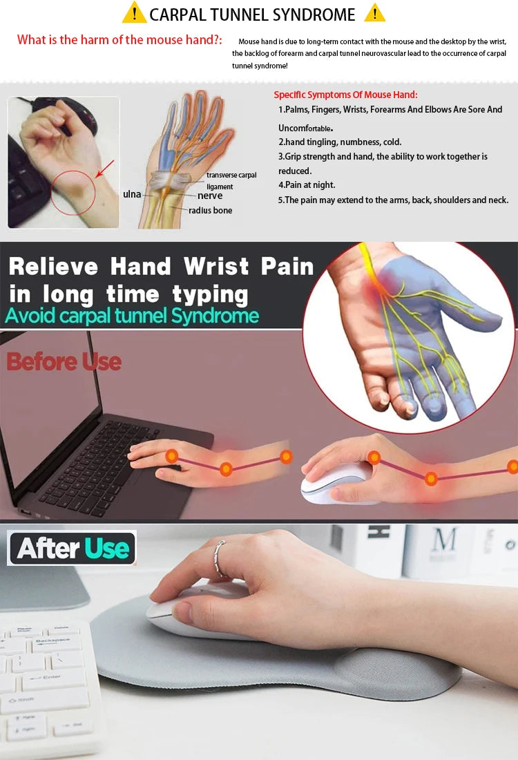 Cute Wrist Guard Silica Gel Support Pad Can Freely Move Office Guard Mouse Pad Ergonomic Wrist Rest Mouse Pad For Pc Laptop Comp